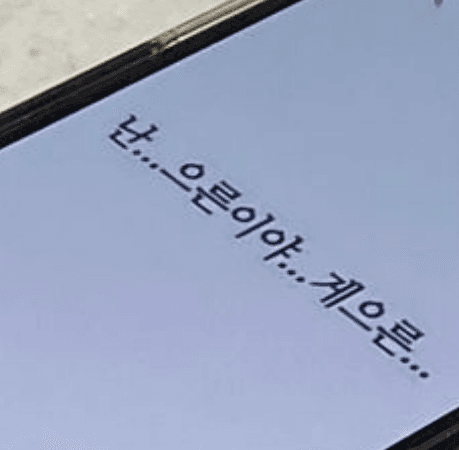 이중턱,볼 처짐 여러 시술 해보다가 울쎄라피프라임 1