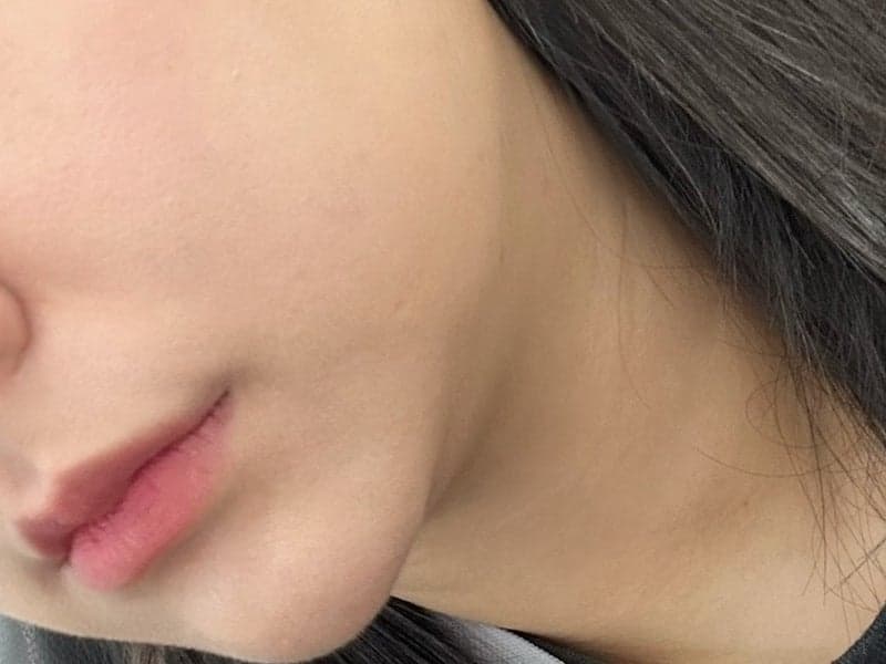 인천 올타이트리프팅 20대 젊줌마 내돈내산 후기 1