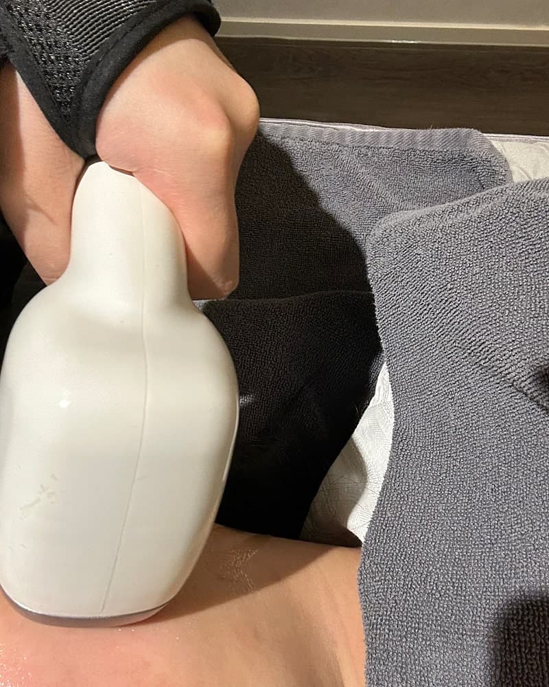 인천 올타이트리프팅 20대 젊줌마 내돈내산 후기 4
