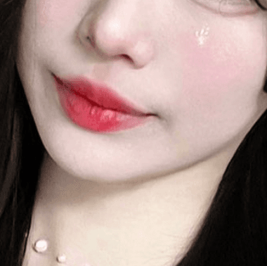 스킨보톡스 가격 후기 (국산 하이톡스 6마넌) 1