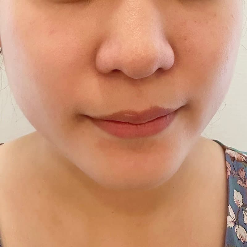 신논현써마지 가격 효과 잘하는 곳 찾음!! 1
