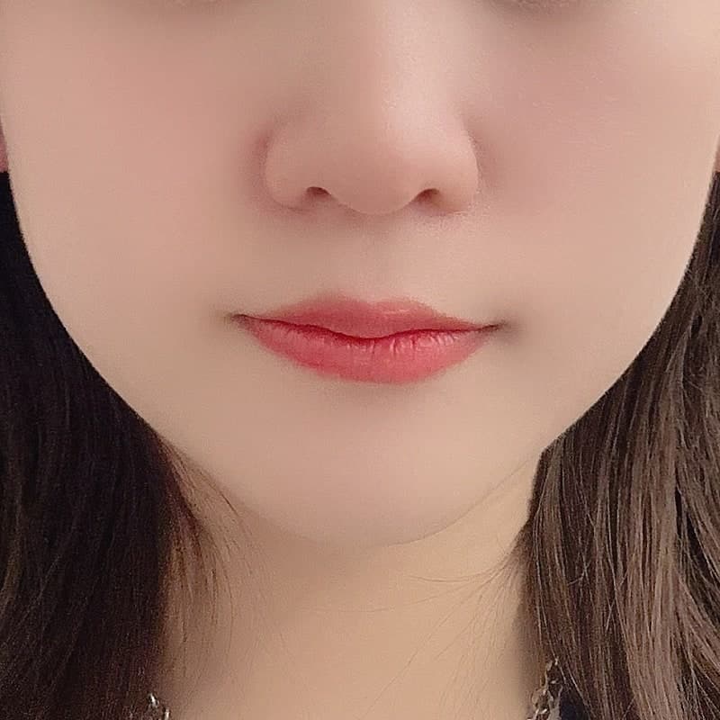 신논현써마지 가격 효과 잘하는 곳 찾음!! 2