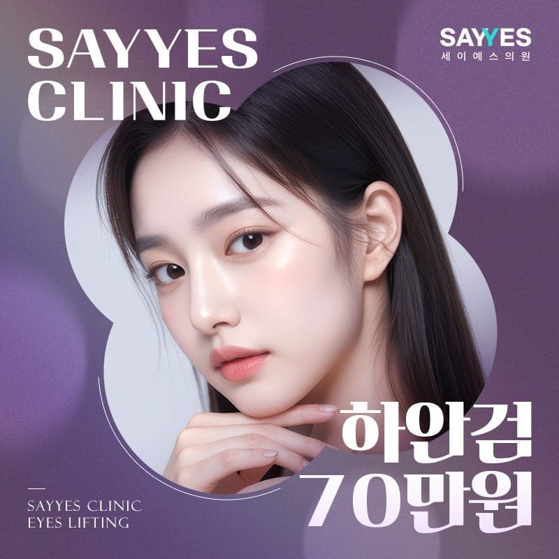 하안검수술후기 비용 70마넌? 2