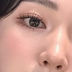 눈가보톡스 부작용 후기 줄임 1