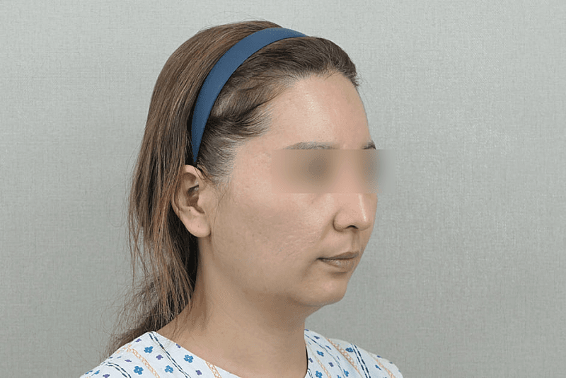 얼굴 아래쪽 무거운거 정리하고 코까지 봤어요!! 1