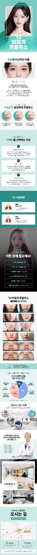 TJ비절개콧볼축소 1