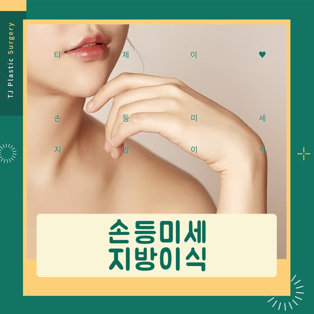 Cấy mỡ vi điểm mu bàn tay TJ