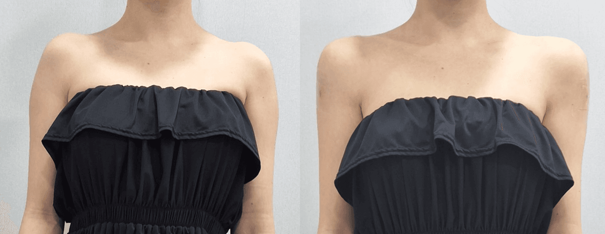 Square shoulder filler... got a redo at QBQ! 🤣