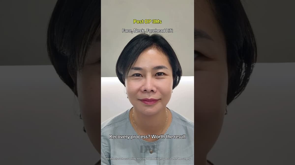 बूढ़ा दिखना मेरी योजना का हिस्सा नहीं था #viral #fyp #trend #viralvideo #facelift #necklift #forehead